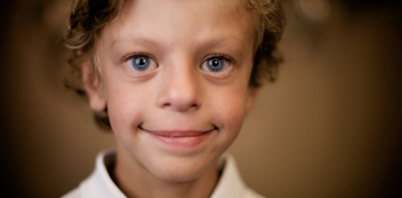 What is Williams Syndrome