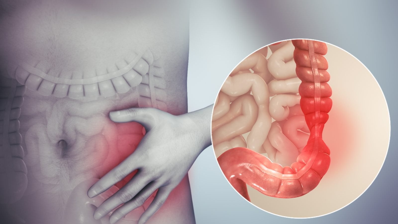 Irritable Bowel Syndrome: Understanding Its ICD-10 Code