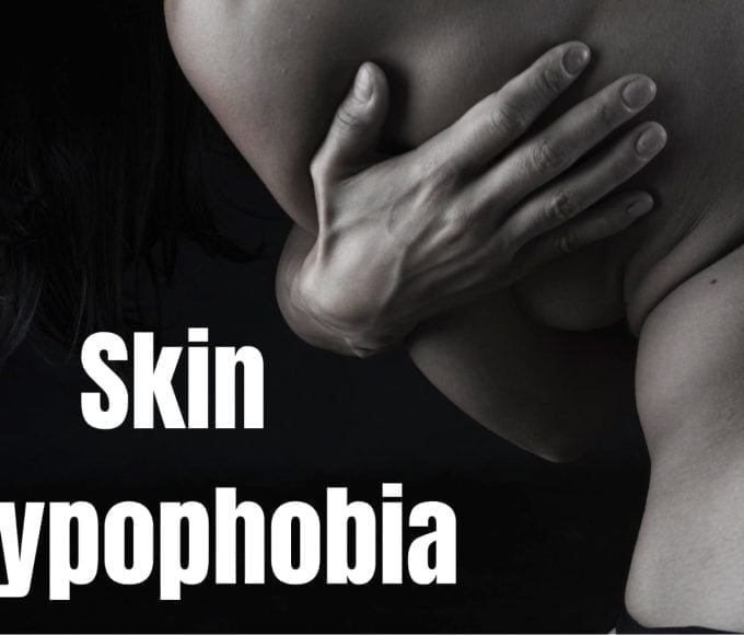 Discover the reality of skin trypophobia, a condition causing fear of clustered skin patterns. Learn its triggers, management strategies