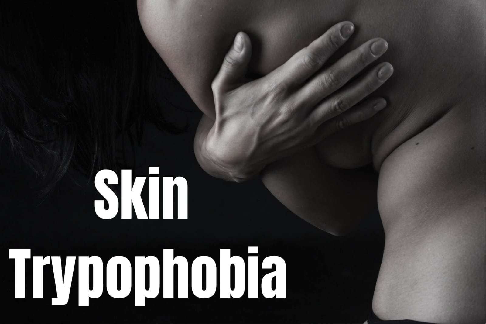 Discover the reality of skin trypophobia, a condition causing fear of clustered skin patterns. Learn its triggers, management strategies