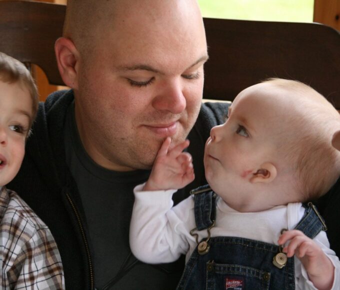 Goldenhar Syndrome: Causes, Symptoms, Treatment, and Future Outlook