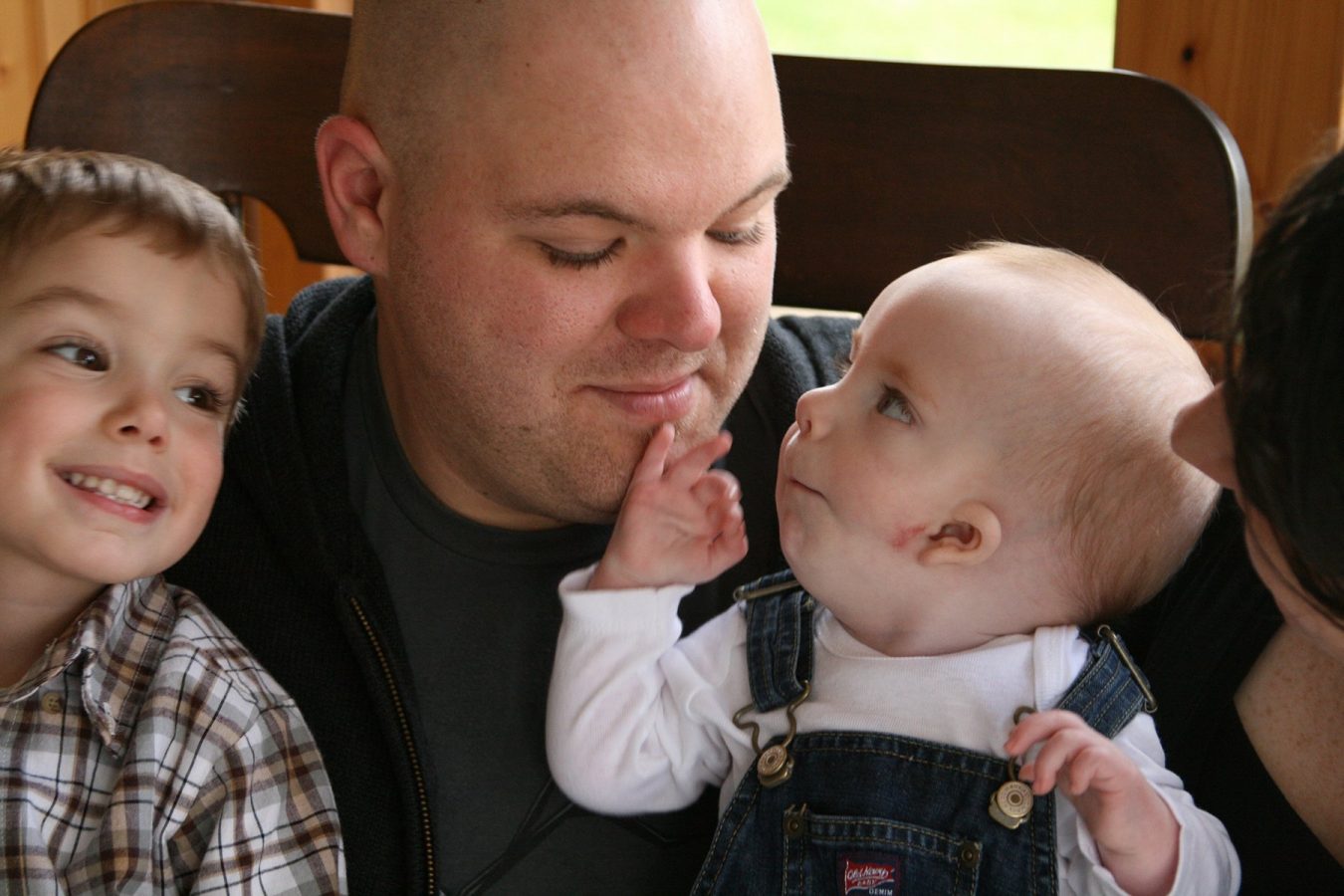 Goldenhar Syndrome: Causes, Symptoms, Treatment, and Future Outlook