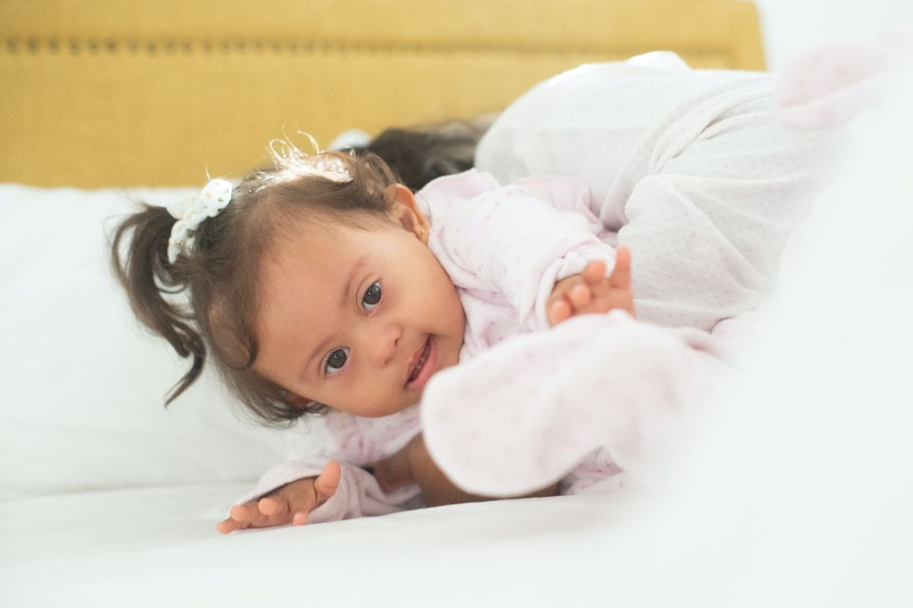 Russell-Silver Syndrome: Causes, Symptoms, Treatment, and Prognosis - A Comprehensive Guide