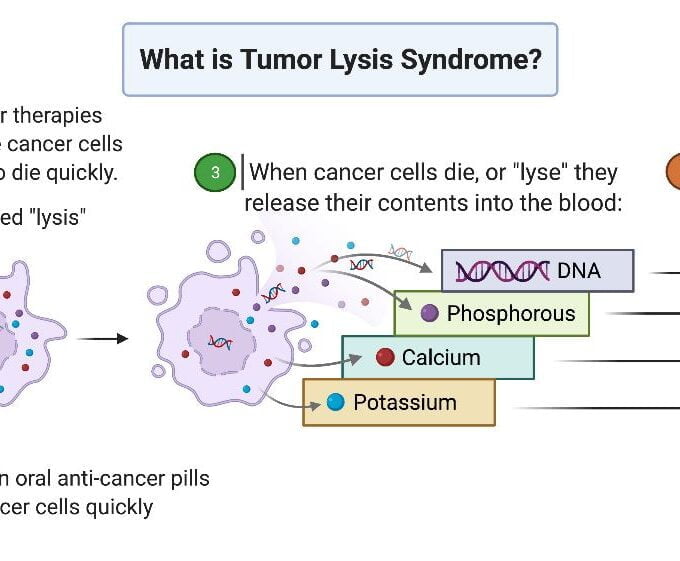 Tumor Lysis Syndrome: Causes, Symptoms, Management, and Global Perspectives
