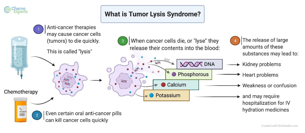 Tumor Lysis Syndrome: Causes, Symptoms, Management, and Global Perspectives